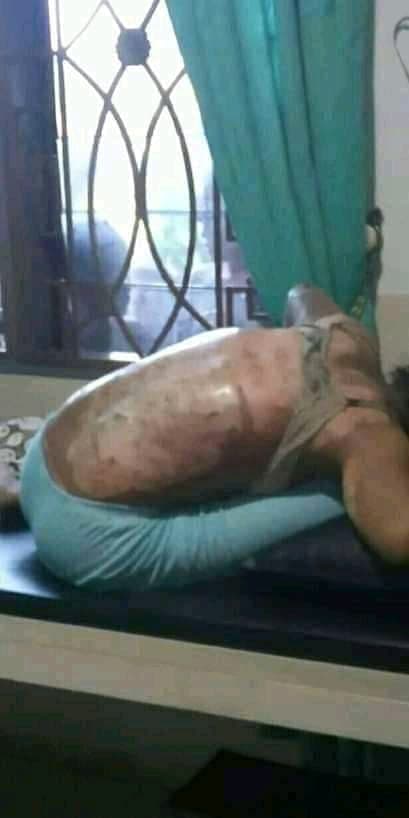 sadis_anak_smp_dibakar_ibu_kandung